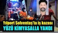 Raju Guntu’nun Yüzü Kimyasal Maddeyle Yandı!