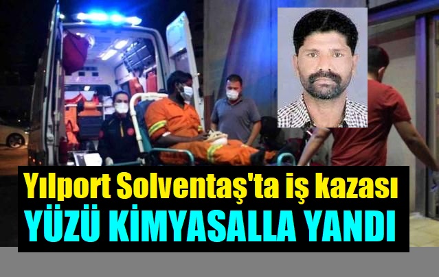 Raju Guntu’nun Yüzü Kimyasal Maddeyle Yandı!